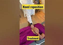 Navel Relocation Adalah